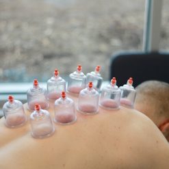 Cupping Therapy